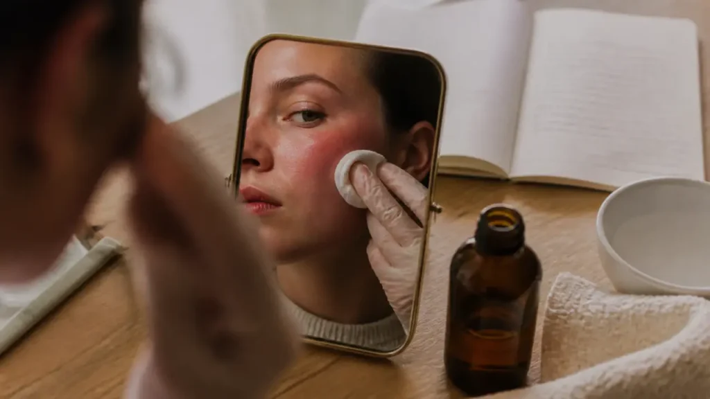 Rougeur visage : irritation passagère, allergie ou rosacée ?